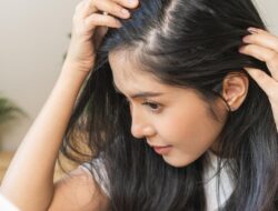 10 Cara ini Boleh Dicoba untuk Menumbuhkan Rambut yang Pitak